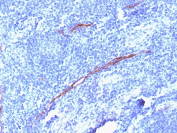 CD34 Antibody Tonsil IHC HPCA1/1806R. Immunohistochemistry analysis of CD34 expression in FFPE human tonsil using an Angiogenesis Marker Antibody, clone HPCA1/1806R, demonstrates membranous HRP-DAB brown staining in endothelial cells forming elongated and branching vascular structures within lymphoid tissue, highlighting active microvascular networks, while surrounding lymphocytes remain largely negative. The staining pattern supports visualization of vascular architecture associated with angiogenic processes. Required HIER: boil tissue sections in 10mM Tris with 1mM EDTA, pH 9, for 10-20 min followed by cooling at RT for 20 min.