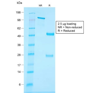 SDS-PAGE analysis of purified, BSA-free recombinant CD34 Antibody / Angiogenesis Marker Antibody (clone HPCA1/1806R) as confirmation of integrity and purity.