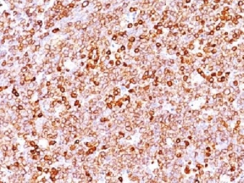 Immunohistochemistry analysis of CD79a / Ig-alpha antibody (clone IGA/1688R) in human tonsil tissue. Formalin-fixed, paraffin-embedded tonsil demonstrates strong membranous and cytoplasmic HRP-DAB brown staining in numerous lymphoid cells within follicular and interfollicular regions, consistent with B lymphocyte distribution. Background staining is minimal, and hematoxylin counterstain highlights overall lymphoid architecture. Heat-induced epitope retrieval was performed by boiling tissue sections in pH 9 10 mM Tris with 1 mM EDTA for 10-20 minutes followed by cooling at room temperature for 20 minutes prior to staining.