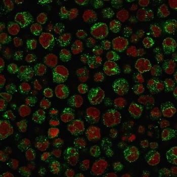 Immunofluorescence analysis of CD79a / Ig-alpha antibody (clone IGA/1688R) in PFA-fixed human Raji cells. CD79a antibody staining (green) demonstrates predominantly cytoplasmic and membranous fluorescence consistent with B cell receptor complex localization. Reddot nuclear stain (red) highlights cell nuclei. The staining pattern aligns with expected CD79a expression in B lymphocyte-derived Raji cells.