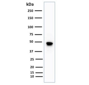 Western blot testing of human Raji cell lysate with CD79a antibody (clone IGA/1688R). Expected molecular weight: 25-47 kDa depending on glycosylation level.