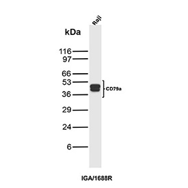 Western blot analysis of CD79a / Ig-alpha antibody (clone IGA/1688R) in human Raji cell lysate. A clear doublet is detected at approximately 45-50 kDa, consistent with the predicted molecular weight range for CD79a and its commonly observed apparent migration on SDS-PAGE. The presence of two closely spaced bands is compatible with CD79a heterogeneity, such as differential N-linked glycosylation and or isoform processing, which can produce a doublet pattern in B cell lysates.