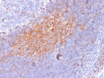 IHC testing of FFPE human lymph node with CD81 antibody (clone 1.3.3.22). Required HIER: boil tissue sections in 10mM citrate buffer, pH 6, for 10-20 min followed by cooling at RT for 20 min.
