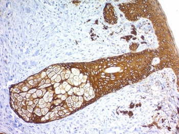 IHC testing of FFPE human skin with recombinant Basic Cytokeratin antibody (clone KRTH/1576R). Required HIER: boil tissue sections in 10mM citrate buffer, pH 6, for 10-20 min followed by cooling at RT for 20 min.