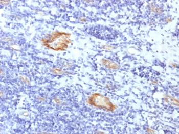 vWF Antibody Clone VWF/1859R immunohistochemistry analysis. IHC staining of FFPE human tonsil using vWF Antibody Clone VWF/1859R (clone VWF/1859R) demonstrates endothelial-specific HRP-DAB brown staining within vascular structures, highlighting blood vessel linings amid surrounding lymphoid tissue. The staining pattern is consistent with von Willebrand factor (VWF) localization to endothelial cells, with signal confined to vessel-associated cells and absent in adjacent lymphocytes. Antigen retrieval was performed using heat-induced epitope retrieval (HIER) in pH 9 Tris-EDTA buffer, supporting robust visualization of vascular endothelium in tonsillar tissue.