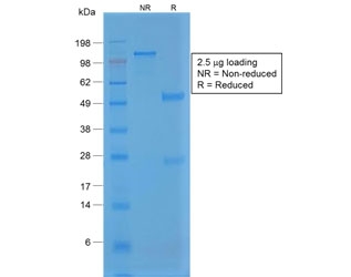 SDS-PAGE analysis of purified, BSA-free recombinant vWF antibody (clone VWF/1859R) as confirmation of integrity and purity.