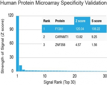Human protein microarray specificity validation of Factor XIIIa Antibody - HuProt Validation. Analysis of the HuProt(TM) microarray containing more than 19,000 full-length human proteins was performed using Factor XIIIa antibody clone F13A1/1448. The antibody demonstrates strongest binding to F13A1 with a Z-score of 120.04 and an S-score of 106.22, showing clear separation from other proteins on the array, including CARNMT1 and ZNF358. These results demonstrate the high specificity of clone F13A1/1448 for Factor XIII A chain.<BR>Z- and S-score explanation: The Z-score represents the strength of the signal generated when the antibody, in combination with a fluorescently tagged anti-IgG secondary antibody, binds to a specific protein on the HuProt(TM) array. Z-scores are expressed in standard deviations above the mean signal of all proteins tested. Proteins are ranked in descending order according to Z-score. The S-score represents the difference between sequential Z-scores and reflects the relative specificity of the antibody for its intended target compared to potential off-target interactions.