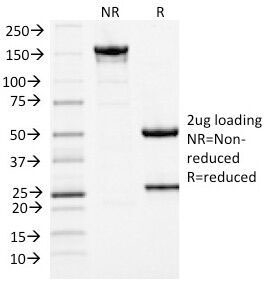 SDS-PAGE Analysis of Purified, BSA-Free MCM7 Antibody (clone MCM7/1467). Confirmation of Integrity and Purity of the Antibody.