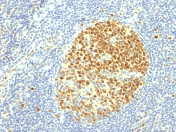 IHC testing of FFPE human tonsil with MCM7 antibody (clone MCM7/1469). Required HIER: boil tissue sections in pH 9 10mM Tris with 1mM EDTA for 10-20 min.