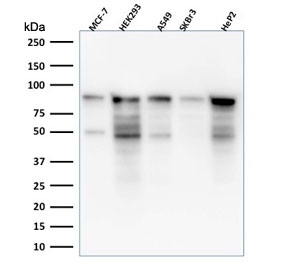 Western blot testing of human samples with microarray validated MCM7 antibody (clone MCM7/1469). Expected molecular weight: 80-90 kDa.
