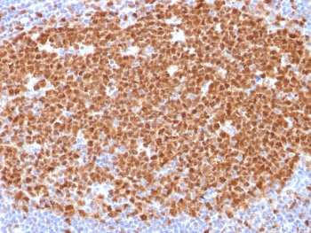 MCM7 Antibody Human Tonsil Tissue IHC. Immunohistochemistry testing of FFPE human tonsil with MCM7 antibody (clone MCM7/1468). Required HIER: boil tissue sections in pH 9 10mM Tris with 1mM EDTA for 10-20 min.