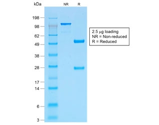 SDS-PAGE analysis of purified, BSA-free recombinant p53 antibody (clone TP53/1799R) as confirmation of integrity and purity.