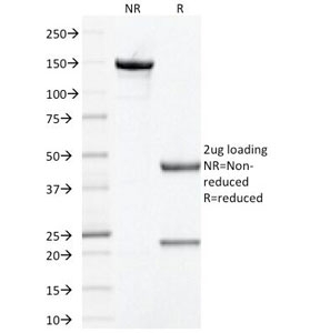 SDS-PAGE Analysis of Purified, BSA-Free Prohibitin Antibody (clone PHB/1881). Confirmation of Integrity and Purity of the Antibody.