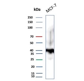 EpCAM Antibody MCF-7 WB. Western blot analysis of human MCF-7 breast carcinoma cell lysate using EpCAM Antibody / Epithelial Cell Marker Antibody (clone EGP40/1372) demonstrates a prominent immunoreactive band at approximately 40-43 kDa. The observed molecular weight is consistent with the glycosylated form of Epithelial Cell Adhesion Molecule (EPCAM/CD326), a transmembrane glycoprotein expressed on epithelial cells and many epithelial-derived tumor cell lines. Additional weaker higher molecular weight signal may represent more extensively glycosylated EpCAM species, protein complexes, or processing intermediates commonly observed for membrane-associated glycoproteins. EpCAM functions in epithelial cell adhesion, maintenance of tissue architecture, and regulation of cellular signaling pathways. Detection in MCF-7 cells is consistent with the established expression of EpCAM in breast epithelial carcinoma models. Expected molecular weight: ~35 kDa (unmodified), ~40-43 kDa (glycosylated).
