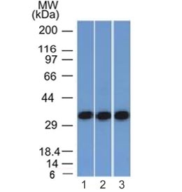 EpCAM Antibody HEK293, A431 & HCT116 WB. Western blot analysis of human HEK293, A431, and HCT116 cell lysates using EpCAM Antibody / Epithelial Cell Marker Antibody (clone EGP40/1372) demonstrates a strong immunoreactive band at approximately 35-40 kDa in all three cell lines. The observed molecular weight is consistent with Epithelial Cell Adhesion Molecule (EPCAM/CD326), a transmembrane glycoprotein that commonly migrates above its calculated molecular mass due to N-linked glycosylation of the extracellular domain. EpCAM functions in epithelial cell adhesion, tissue organization, and cellular signaling, and is widely expressed by epithelial-derived cell lines and carcinomas. The robust signal observed across HEK293, A431, and HCT116 cells is consistent with established EpCAM expression in epithelial cell populations and supports the specificity of clone EGP40/1372 for detection of EPCAM by western blot. Expected molecular weight: ~35 kDa (unmodified), ~40-43 kDa (glycosylated).