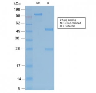 SDS-PAGE analysis of purified, BSA-free recombinant TRAcP antibody (clone ACP5/2336R) as confirmation of integrity and purity.