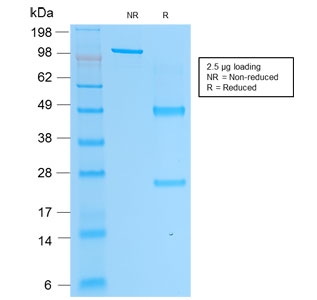 SDS-PAGE analysis of purified, BSA-free PSAP Antibody Recombinant Mouse MAb rACPP/1338 as confirmation of integrity and purity.
