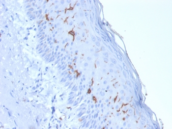 CD1A Antibody for IHC. Immunohistochemistry analysis of CD1A / CD1a expression in FFPE human skin using CD1A Antibody. Membranous and cytoplasmic staining is observed in scattered dendritic cells within the epidermis, consistent with Langerhans cell localization, while surrounding keratinocytes remain largely negative. The presence of CD1a-positive cells along the epithelial layer reflects dendritic cell differentiation within the epidermis and supports identification of developing antigen-presenting cells in tissue. Required HIER: boil tissue sections in 10 mM citrate buffer, pH 6, for 10-20 minutes.