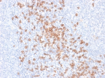 CD8A Antibody Tonsil IHC. Immunohistochemistry analysis of CD8 alpha (CD8A) in FFPE human tonsil tissue shows strong membranous staining of cytotoxic T lymphocytes within lymphoid regions, consistent with expected localization of CD8-positive T cells and supporting identification of immune cell populations in secondary lymphoid tissue. HuProt microarray validated antibody performance supports specificity-focused detection in complex immune-rich samples (clone rC8/468). Heat-induced epitope retrieval was performed in 10 mM citrate buffer, pH 6.0, for 10-20 minutes followed by cooling at room temperature.