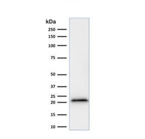 p21 Antibody Human HeLa WB. Western blot testing of human HeLa cell lysate with recombinant p21 antibody (clone rCIP1/823).