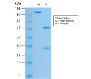SDS-PAGE analysis of purified, BSA-free recombinant CFTR antibody (clone rCFTR/1342) as confirmation of integrity and purity.