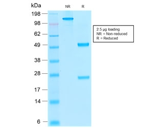 SDS-PAGE analysis of purified, BSA-free recombinant Thrombomodulin antibody (clone rTHBD/1591) as confirmation of integrity and purity.