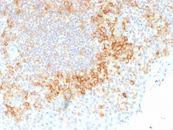 CD27 Antibody Human Tonsil IHC. Immunohistochemistry analysis of CD27 / TNFRSF7 expression in FFPE human tonsil tissue using CD27 Antibody / T Cell Activation Marker Antibody clone rLPFS2/1611. Strong membranous HRP-DAB brown staining is observed in lymphocyte populations within interfollicular regions and surrounding germinal centers, consistent with CD27 expression on activated T cells and antigen-experienced lymphocytes, while adjacent non-lymphoid structures remain largely negative. The staining pattern highlights T cell activation zones and supports identification of functional immune compartments within tonsillar tissue. Heat-induced epitope retrieval was performed in 10 mM Tris buffer with 1 mM EDTA, pH 9, for 10-20 minutes followed by cooling prior to antibody incubation.