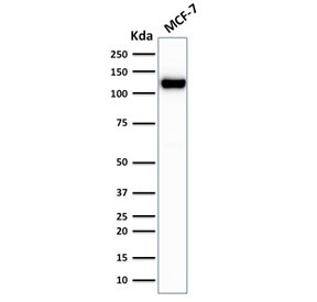 Western blot testing of human MCF-7 cell lysate with recombinant E-Cadherin antibody (clone rCDH1/1525). Expected molecular weight: 135 kDa (precursor), 80-120 kDa (mature, depending on glycosylation level).