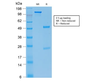 SDS-PAGE analysis of purified, BSA-free E-Cadherin antibody (clone rCDH1/1525) as confirmation of integrity and purity.