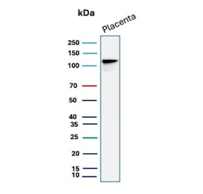 Western blot testing of human placental tissue lysate with E-Cadherin antibody (clone rCDH1/1525). Expected molecular weight: 135 kDa (precursor), 80-120 kDa (mature, depending on glycosylation level).