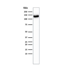 Western blot testing of human MCF-7 cell lysate with recombinant E-Cadherin antibody (clone CDH1/2208R). Expected molecular weight: 135 kDa (precursor), 80-120 kDa (mature, depending on glycosylation level).