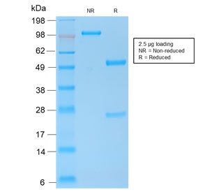 SDS-PAGE analysis of purified, BSA-free E-Cadherin antibody (clone CDH1/2208R) as confirmation of integrity and purity.