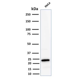 Ferritin Light Chain Antibody for WB HeLa. Western blot testing of human HeLa lysate with Ferritin Light Chain antibody. Predicted molecular weight: ~20 kDa.