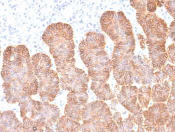 EpCAM Antibody Skin IHC. Immunohistochemistry testing of FFPE human skin with recombinant EpCAM antibody (clone rEGP40/1372). Required HIER: boil tissue sections in 10mM citrate buffer, pH 6, for 10-20 min followed by cooling at RT for 20 min.