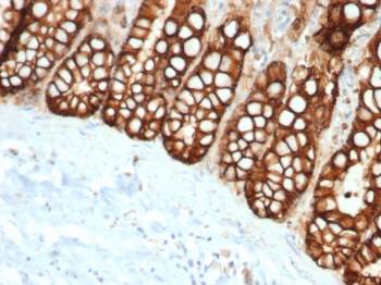 EpCAM Antibody FFPE Cat Small Intestine Tissue IHC. Immunohistochemistry staining of FFPE cat small intestine with recombinant EpCAM antibody (clone rEGP40/1372). HIER: boil tissue sections in pH 9 10mM Tris with 1mM EDTA for 20 min and allow to cool before testing.
