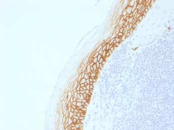 CD44v9 Antibody for IHC Tonsil. Immunohistochemistry analysis of CD44 variant 9 / CD44 expression in FFPE human tonsil using recombinant CD44v9 antibody (clone CD44v9/2344R). Prominent membranous HRP-DAB brown staining is observed along the epithelial layer, with sharp contrast to the underlying lymphoid compartment, highlighting cell surface localization consistent with CD44v9-mediated adhesion at epithelial-immune interfaces. The staining pattern emphasizes boundary organization between epithelial structures and lymphoid tissue, supporting its role in lymphoid activation and tissue architecture within tonsillar immune microenvironments. Heat induced epitope retrieval was performed by boiling tissue sections in pH 9 10mM Tris with 1mM EDTA for 10-20 min followed by cooling at RT for 20 min.
