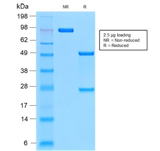 SDS-PAGE analysis of purified, BSA-free recombinant CD44v9 antibody (clone CD44v9/2344R) as confirmation of integrity and purity.