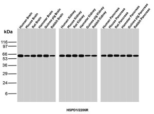 Recombinant HSP60 Antibody HSPD1/2206R Multi-Species Tissue Expression WB. Western blot testing of brain, kidney and pancreas tissue lysates from human, mouse, rat, hamster, guinea pig and rabbit with Recombinant HSP60 Antibody clone HSPD1/2206R shows a strong, specific band at approximately 60 kDa across all tested samples. The observed band is consistent with the expected molecular weight of HSPD1 and demonstrates broad recognition of HSP60 across multiple mammalian species and tissue types.