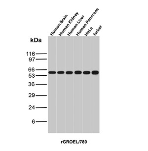HSP60 Antibody / Heat Shock Protein 60 Antibody in Human Tissues and Cell Lines WB. Western blot testing of human brain, kidney, liver and pancreas tissue lysates and HeLa cervical cancer and Jurkat T-cell leukemia cell lysates with HSP60 Antibody clone rGROEL/780 shows a strong, specific band at approximately 60 kDa across all samples. The observed band is consistent with the expected molecular weight of HSPD1 and demonstrates robust HSP60 detection across the tested human tissues and cell lines.