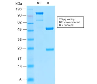 SDS-PAGE analysis of purified, BSA-free CD52 antibody (clone CD52/2276R) as confirmation of integrity and purity.
