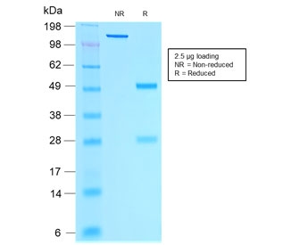 SDS-PAGE analysis of purified, BSA-free recombinant Estrogen Receptor alpha antibody (clone rESR1/1935) as confirmation of integrity and purity.