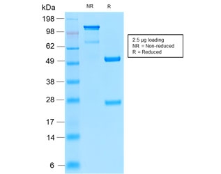 SDS-PAGE analysis of purified, BSA-free recombinant Insulin Receptor alpha antibody (clone INSR/2277R) as confirmation of integrity and purity.