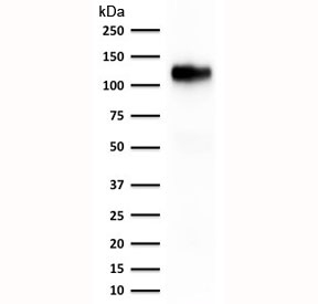 Western blot testing of human kidney lysate with Cadherin 16 antibody (clone rCDH16/1071).