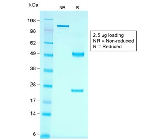 SDS-PAGE analysis of purified, BSA-free recombinant Cadherin 16 antibody (clone rCDH16/1071) as confirmation of integrity and purity.