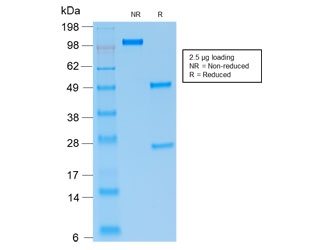 SDS-PAGE analysis of purified, BSA-free recombinant PAX5 antibody (clone rPAX5/2060) as confirmation of integrity and purity.