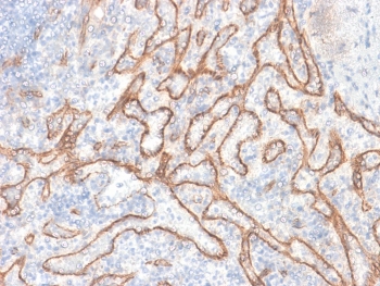 Beta-Catenin Antibody Tonsil IHC. Immunohistochemistry of human tonsil tissue using Beta-Catenin Antibody (clone CTNNB1/2030R) shows distinct membranous staining outlining epithelial cell borders within crypt regions, consistent with CTNNB1 / Catenin beta-1 localization at adherens junctions, with mild cytoplasmic signal in select epithelial cells. Lymphoid compartments display minimal staining, highlighting tissue-specific expression patterns. Hematoxylin counterstain provides nuclear contrast for structural context. HIER: boil FFPE tissue sections in 10 mM citrate buffer, pH 6, for 10-20 min followed by cooling at RT for 20 min.