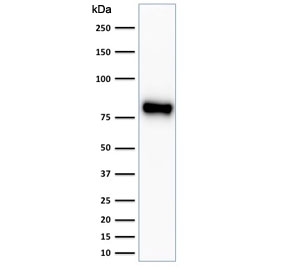 Beta-Catenin Antibody HeLa WB. Western blot analysis of human HeLa cell lysate using Beta-Catenin Antibody (clone CTNNB1/2030R) detects a prominent band at approximately 90-95 kDa, consistent with the predicted molecular weight of Catenin beta-1 / CTNNB1 at ~85 kDa with a modest upward shift commonly observed in SDS-PAGE. This migration difference is consistent with known phosphorylation of beta-catenin, which can alter electrophoretic mobility. The single dominant band supports specific detection of CTNNB1 in HeLa cells.