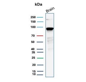 Beta-Catenin Antibody Brain WB. Western blot analysis of human brain tissue lysate using Beta-Catenin Antibody (clone CTNNB1/2030R) detects a clear band at approximately 90-95 kDa, consistent with the predicted molecular weight of Catenin beta-1 / CTNNB1 at ~85 kDa with a commonly observed upward shift during SDS-PAGE. This shift is consistent with known phosphorylation of beta-catenin, which can affect electrophoretic mobility. The band pattern aligns with expected expression of CTNNB1 in neural tissue.