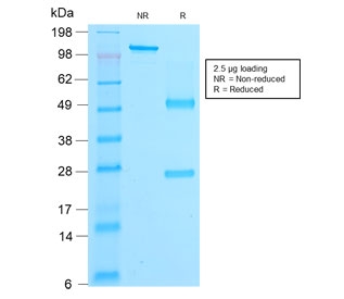 SDS-PAGE analysis of purified, BSA-free recombinant beta Catenin antibody (clone rCTNNB1/2173) as confirmation of integrity and purity.