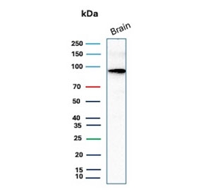 Beta-Catenin Transcriptional Marker Brain WB. Western blot analysis of human brain tissue lysate using Beta-Catenin Antibody (clone rCTNNB1/2173) detects a band at approximately 90-95 kDa, consistent with the predicted molecular weight of Catenin beta-1 / CTNNB1 at ~85 kDa with a characteristic upward shift during SDS-PAGE. This migration pattern is consistent with phosphorylation states of beta-catenin associated with regulation of its stability and transcriptional activity within the Wnt signaling pathway.